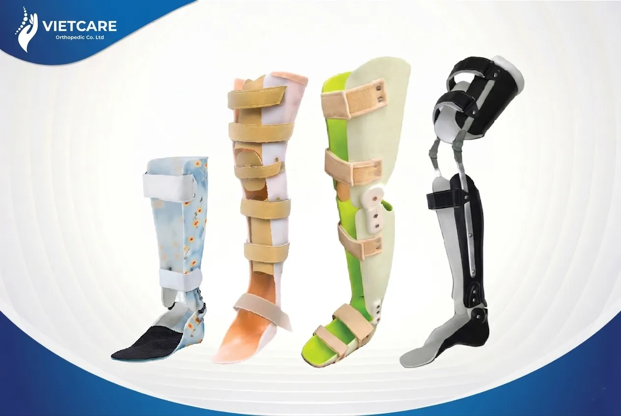 Máng - Nẹp chỉnh hình