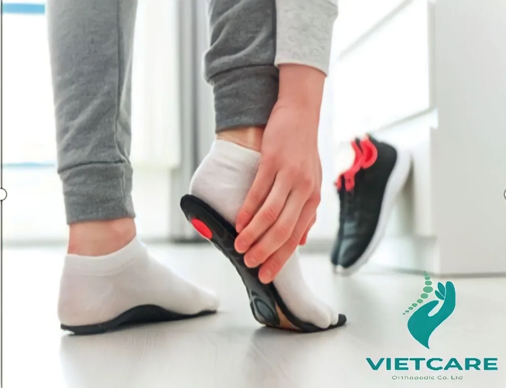 5 dấu hiệu nhận biết sớm trẻ có bàn chân bẹt