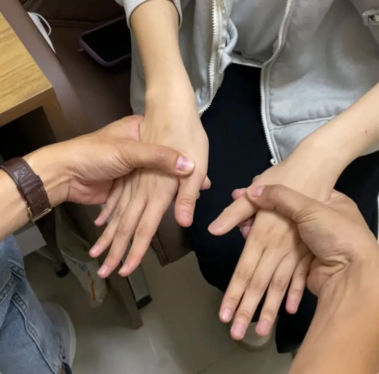 Ngón tay – Ngón chân thẩm mỹ